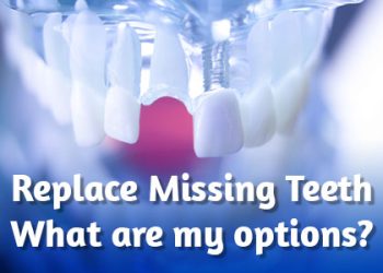 San Diego dentists at Bay Park Dental Group, discuss the tooth replacement options available to replace missing teeth and restore your smile.